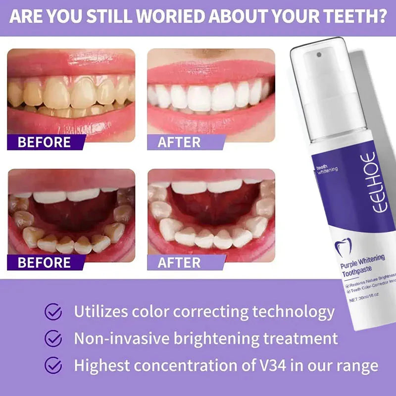 New Teeth Whitening Toothpaste 5D Oral Hygiene Cleaning Teeth Whitening Tool Fresh Breath Teeth Care