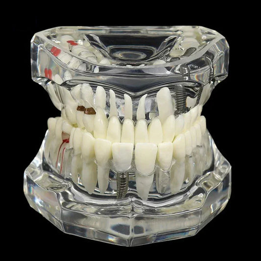 Dental Models Removable And Restorable Models Of Diseased Teeth For Teaching And Researching Medical And Dental Diseases