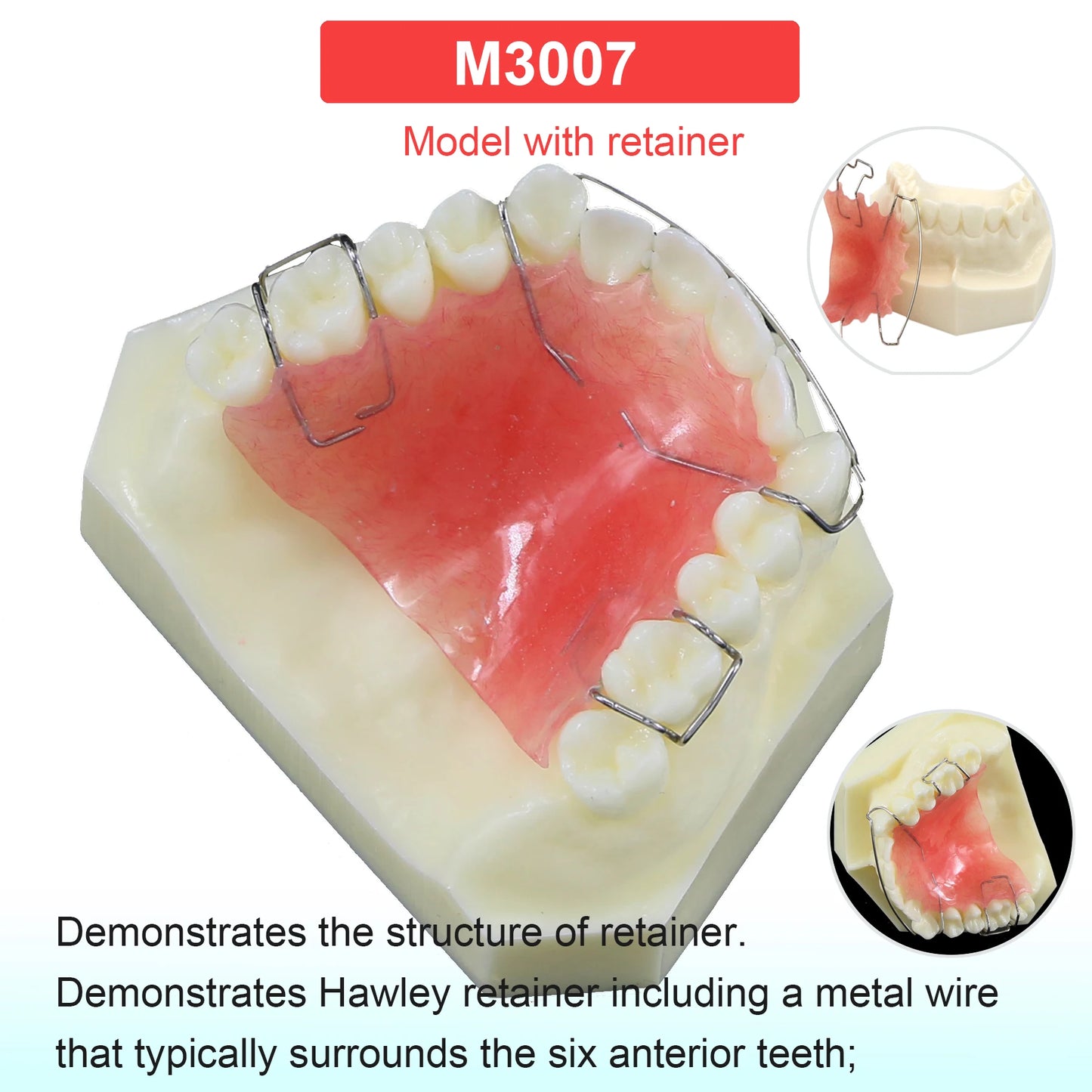 Dental Teeth Model Dental Teaching Models Implant Model Removable Dentistry Model Teeth For Training Studying Patient Education