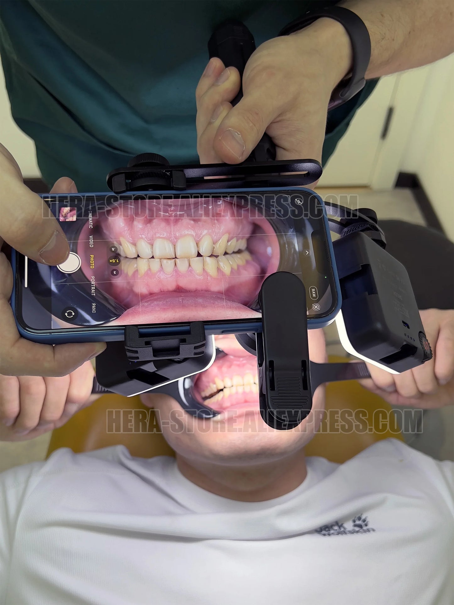 Dental Photography Kit, Mobile Phone LED Light for Dentistry Photo Video Equipment Oral Filling Light for Dentists