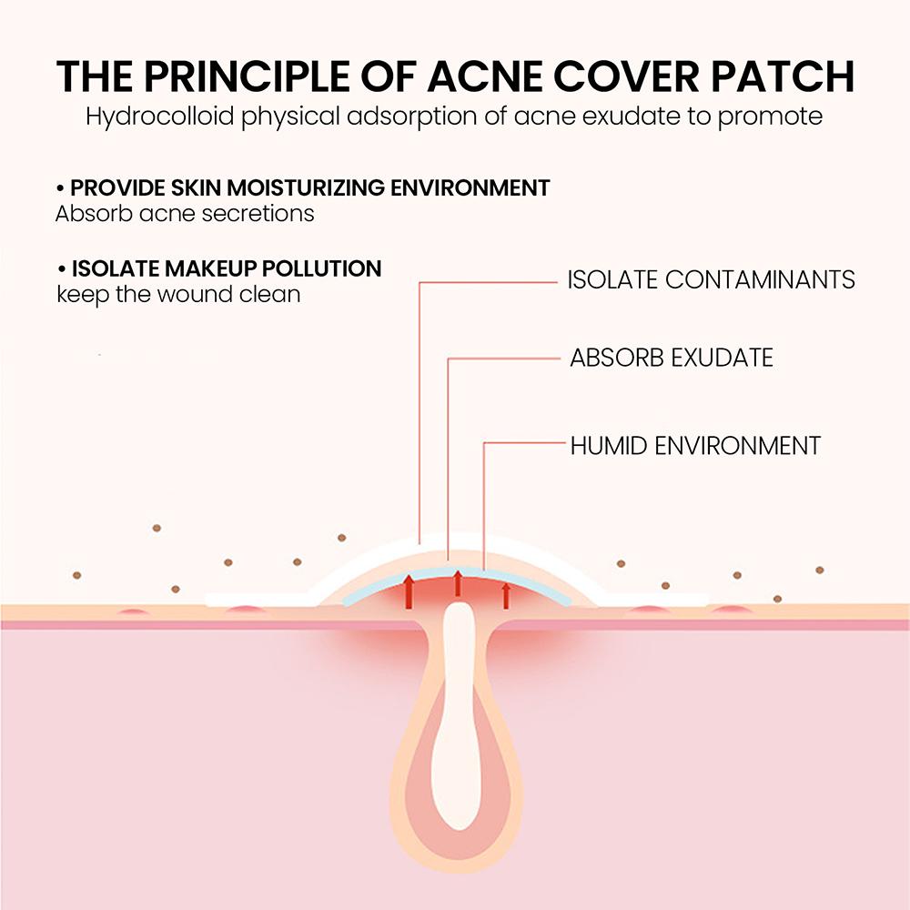 200 Patches Acnes Pimple Patches for Zits and Blemishes,Spots Treatments Stickers for Face and Skin
