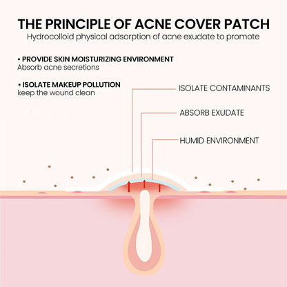 200 Patches Acnes Pimple Patches for Zits and Blemishes,Spots Treatments Stickers for Face and Skin