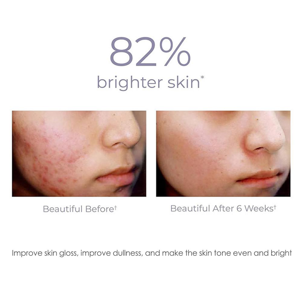 2/1PCs Vitamin C Facial Spray Mist Green Tea Toner Nourishing Relieve Redness Moisturizing Vitamin C For Face Mist Spray 50ml