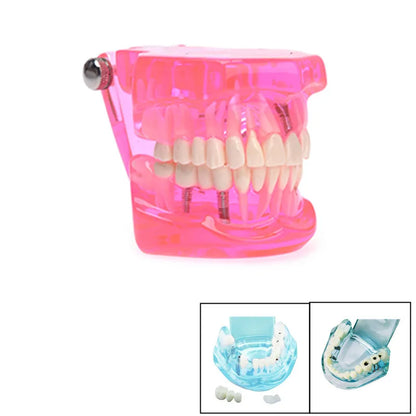 41 Styles Dental Model Teeth Teaching Model Dentist Typodont Orthodontic Jaw Model For Studying   Dentistry Products Accessories