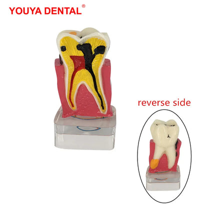 41 Styles Dental Model Teeth Teaching Model Dentist Typodont Orthodontic Jaw Model For Studying   Dentistry Products Accessories