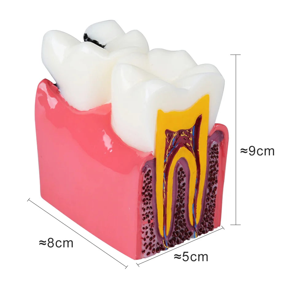 41 Styles Dental Model Teeth Teaching Model Dentist Typodont Orthodontic Jaw Model For Studying   Dentistry Products Accessories