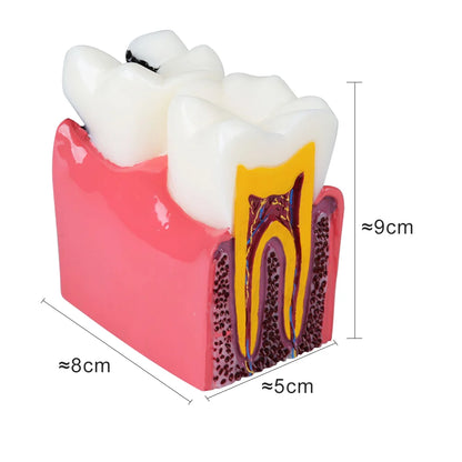 41 Styles Dental Model Teeth Teaching Model Dentist Typodont Orthodontic Jaw Model For Studying   Dentistry Products Accessories