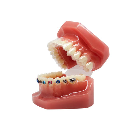 41 Styles Dental Model Teeth Teaching Model Dentist Typodont Orthodontic Jaw Model For Studying   Dentistry Products Accessories