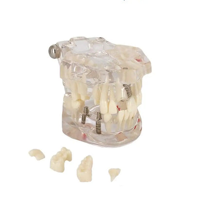 41 Styles Dental Model Teeth Teaching Model Dentist Typodont Orthodontic Jaw Model For Studying   Dentistry Products Accessories