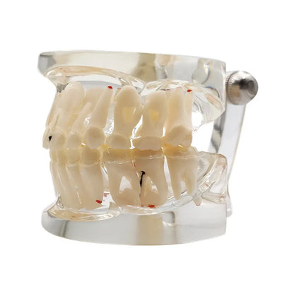 41 Styles Dental Model Teeth Teaching Model Dentist Typodont Orthodontic Jaw Model For Studying   Dentistry Products Accessories