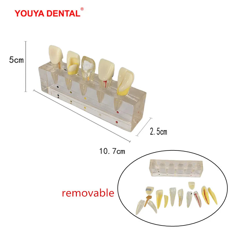 41 Styles Dental Model Teeth Teaching Model Dentist Typodont Orthodontic Jaw Model For Studying   Dentistry Products Accessories