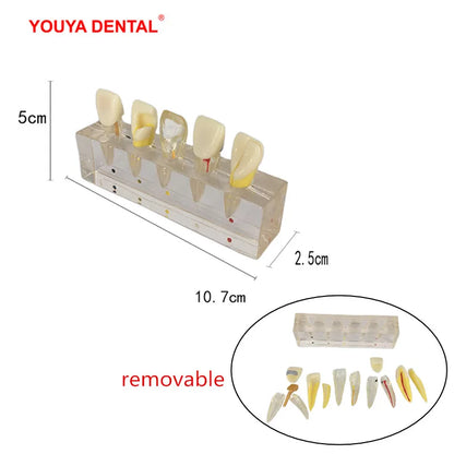 41 Styles Dental Model Teeth Teaching Model Dentist Typodont Orthodontic Jaw Model For Studying   Dentistry Products Accessories
