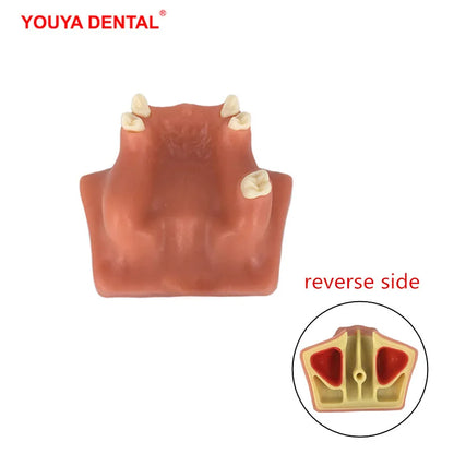 41 Styles Dental Model Teeth Teaching Model Dentist Typodont Orthodontic Jaw Model For Studying   Dentistry Products Accessories