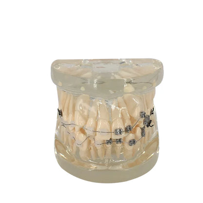 41 Styles Dental Model Teeth Teaching Model Dentist Typodont Orthodontic Jaw Model For Studying   Dentistry Products Accessories
