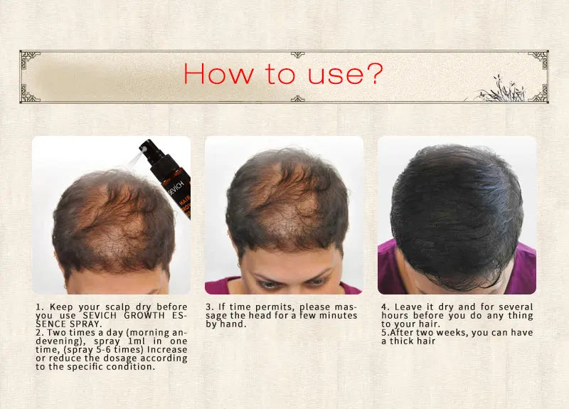 Sevich 30ml Hebal Oil Essence Fast Hair Growth Spray Hair Loss Treatment Help for hair Growth Hair Care