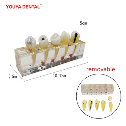 41 Styles Dental Model Teeth Teaching Model Dentist Typodont Orthodontic Jaw Model For Studying   Dentistry Products Accessories