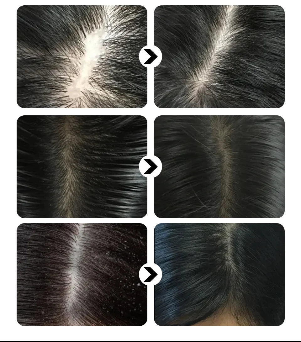 Sevich Hair growth ginger shampoo 100ml Anti Hair Loss. Sevich Hair Growth Ginger shampoo 100ml anti hair loss