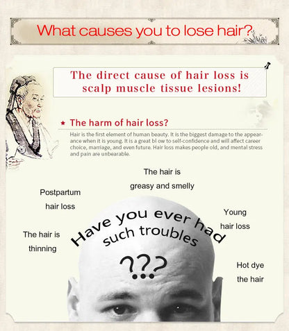 Sevich 30ml Hebal Oil Essence Fast Hair Growth Spray Hair Loss Treatment Help for hair Growth Hair Care