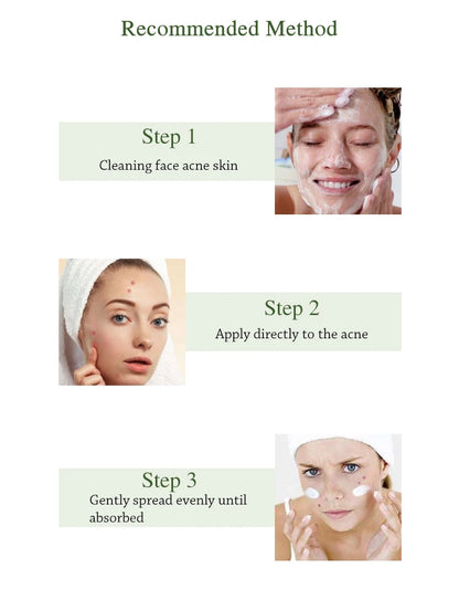 JoyPretty Herbal Acne Face Cream Body Pimple Treatment Oil Control Moisturizing Facial Creams Skin Care Products Beauty