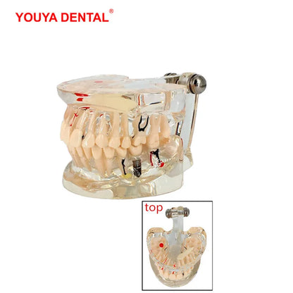 41 Styles Dental Model Teeth Teaching Model Dentist Typodont Orthodontic Jaw Model For Studying   Dentistry Products Accessories
