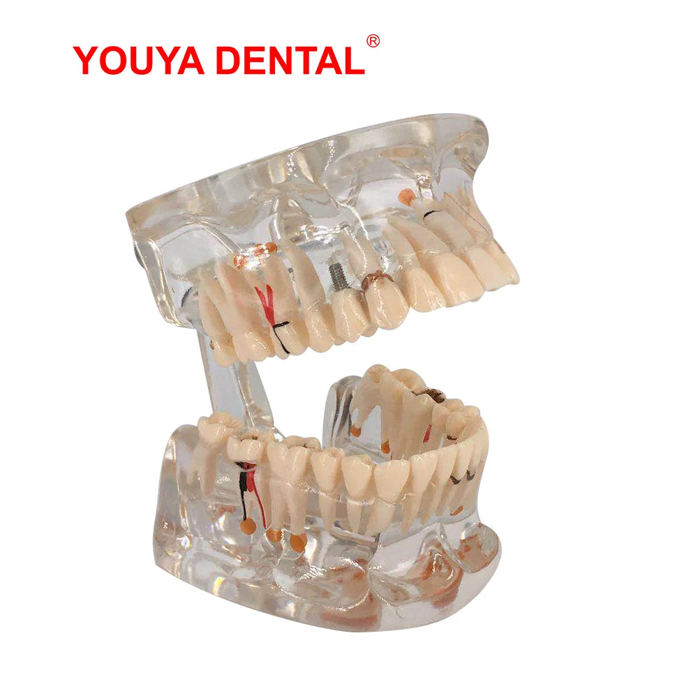 41 Styles Dental Model Teeth Teaching Model Dentist Typodont Orthodontic Jaw Model For Studying   Dentistry Products Accessories