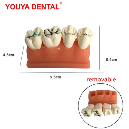 41 Styles Dental Model Teeth Teaching Model Dentist Typodont Orthodontic Jaw Model For Studying   Dentistry Products Accessories