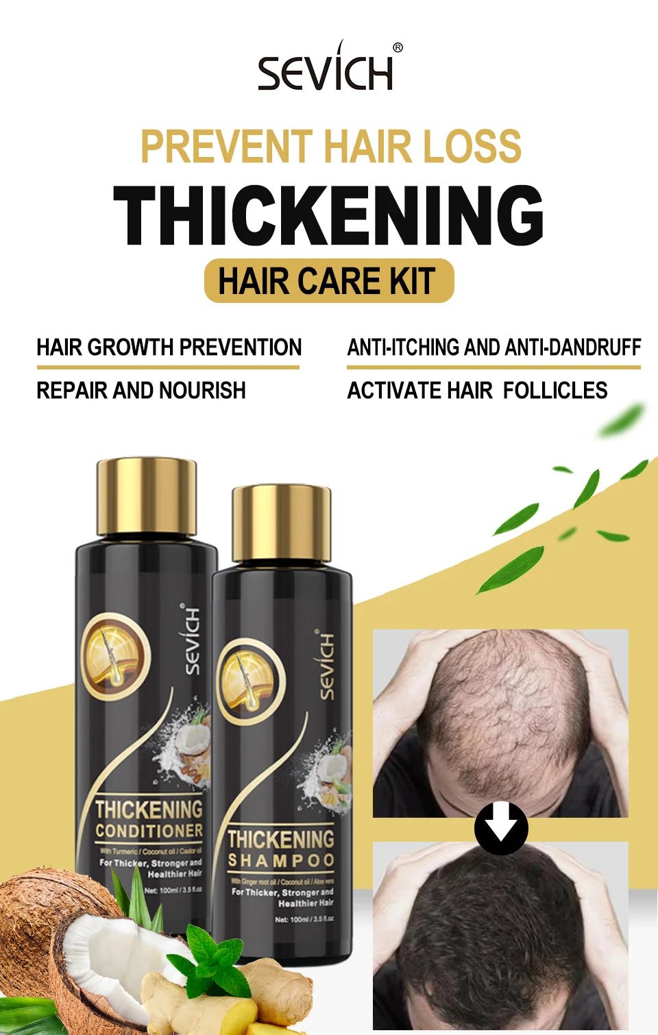 Sevich Hair growth ginger shampoo 100ml Anti Hair Loss. Sevich Hair Growth Ginger shampoo 100ml anti hair loss