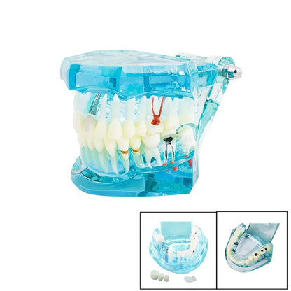 41 Styles Dental Model Teeth Teaching Model Dentist Typodont Orthodontic Jaw Model For Studying   Dentistry Products Accessories