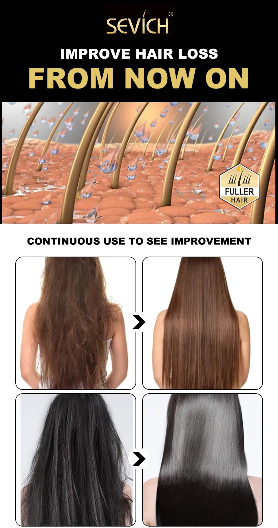 Sevich Hair growth ginger shampoo 100ml Anti Hair Loss. Sevich Hair Growth Ginger shampoo 100ml anti hair loss