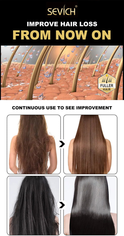 Sevich Hair growth ginger shampoo 100ml Anti Hair Loss. Sevich Hair Growth Ginger shampoo 100ml anti hair loss