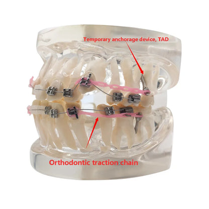 41 Styles Dental Model Teeth Teaching Model Dentist Typodont Orthodontic Jaw Model For Studying   Dentistry Products Accessories
