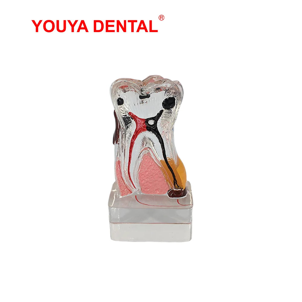 41 Styles Dental Model Teeth Teaching Model Dentist Typodont Orthodontic Jaw Model For Studying   Dentistry Products Accessories