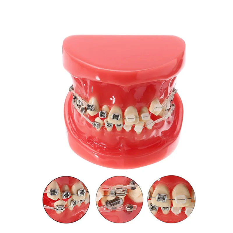 41 Styles Dental Model Teeth Teaching Model Dentist Typodont Orthodontic Jaw Model For Studying   Dentistry Products Accessories