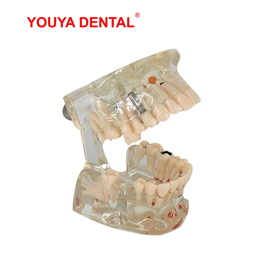 41 Styles Dental Model Teeth Teaching Model Dentist Typodont Orthodontic Jaw Model For Studying   Dentistry Products Accessories