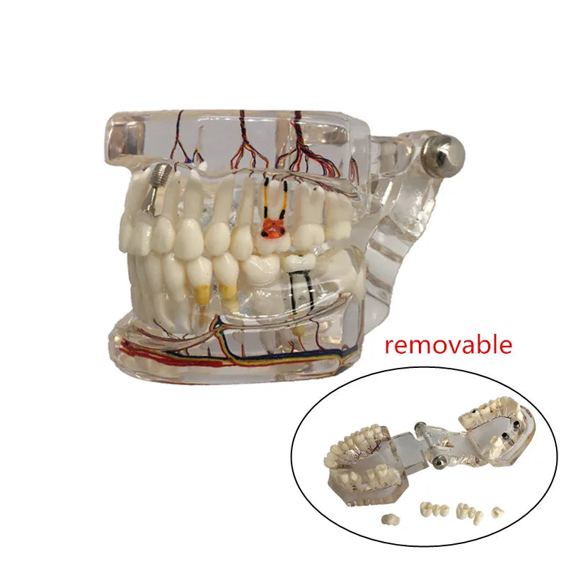 41 Styles Dental Model Teeth Teaching Model Dentist Typodont Orthodontic Jaw Model For Studying   Dentistry Products Accessories