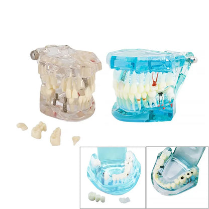 41 Styles Dental Model Teeth Teaching Model Dentist Typodont Orthodontic Jaw Model For Studying   Dentistry Products Accessories