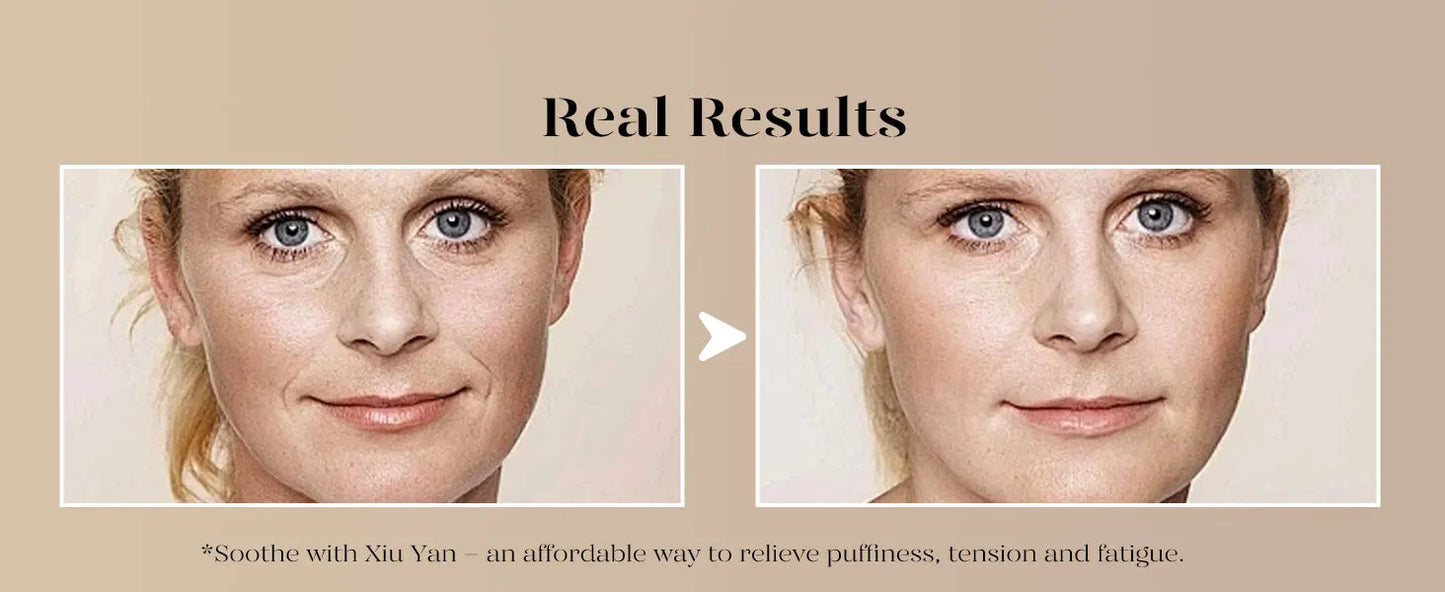 Facial Care Tools Suitable for Reducing Swelling and Redness Skincare Programs, Men's and Women's Self-care Gifts