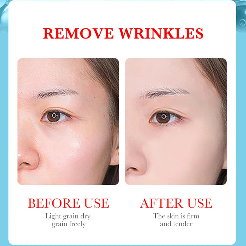 Kojic Acid Retinol Serum for Brightening Firming Hydrating for Face Anti Aging Serums, Dark Spot Correcting Essence