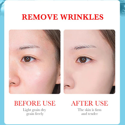 Kojic Acid Retinol Serum for Brightening Firming Hydrating for Face Anti Aging Serums, Dark Spot Correcting Essence