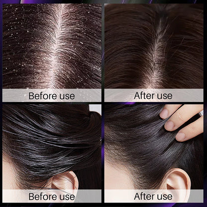 Hair Growth Thickening Shampoo Hair Growth Deep Cleansing Volumizing Shampoo Rosemary Onion Shampoo Hair Thickening Care Product