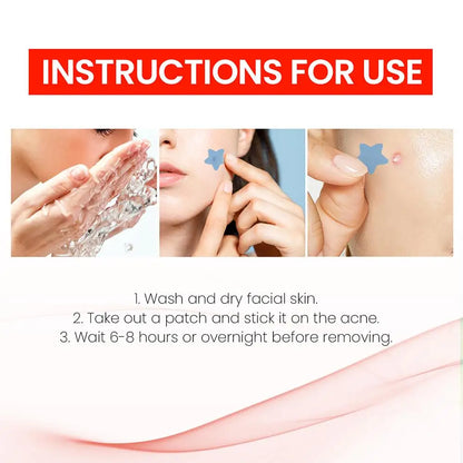 200pcs Star Shape Pimple Patches Colorful Hydrocolloid Pimple Healing Sticker Cute Strong Absorption Zit Patches Face Care