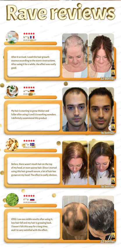 2025 Hair growth oil, repair baldness, hairline, rapid hair growth hair growth oil for men