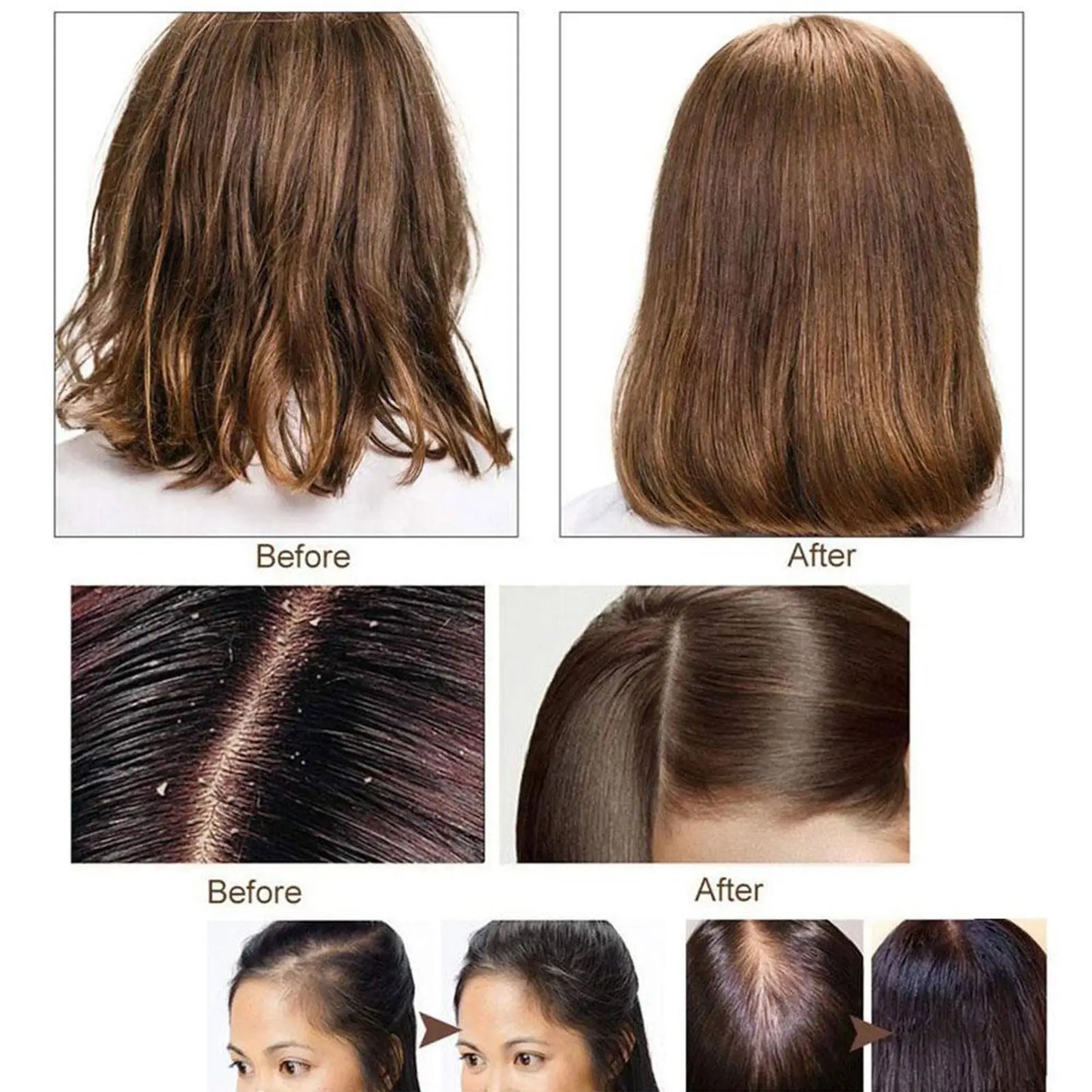 Ginger Polygonum Soap Shampoo Soap Cold Processed Soap Hair Shampoo Bar Pure Plant Hair Shampoos Hair Care