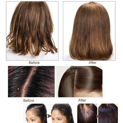 Ginger Polygonum Soap Shampoo Soap Cold Processed Soap Hair Shampoo Bar Pure Plant Hair Shampoos Hair Care