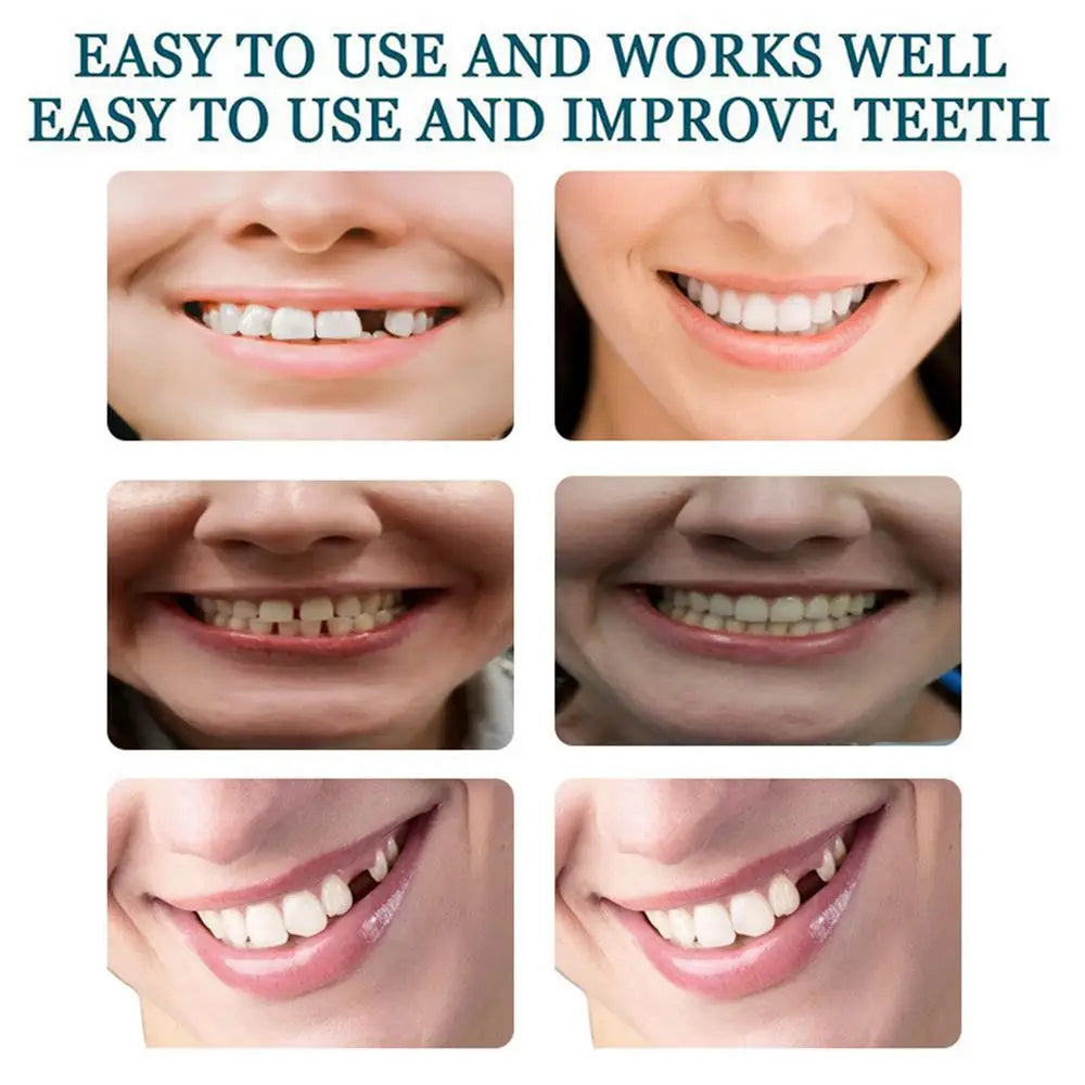 Fake Teeth Veneers Detachable And Reusable Veneers Teeth Teeth With Comfortable Fit Temporary Teeth Dentures Fake Tooth For