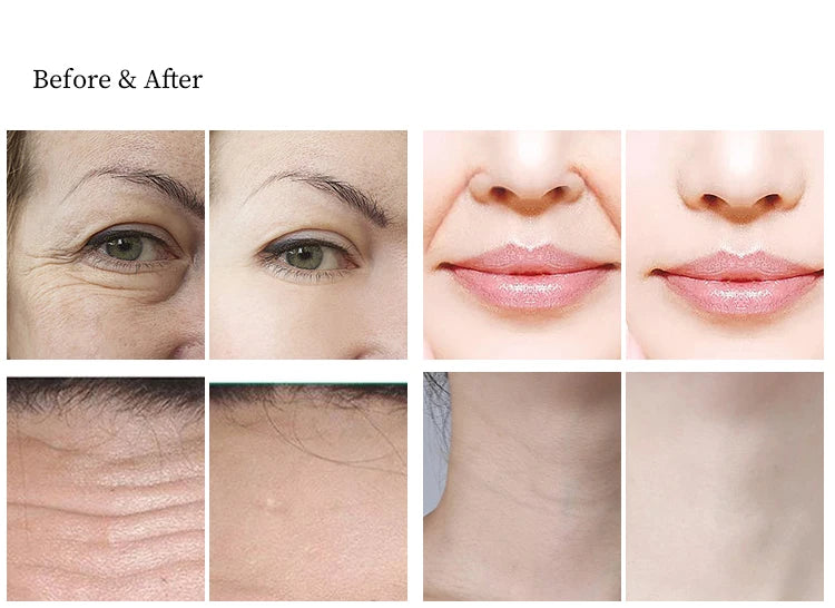 Portable newest original factory Newest facial and Body care Machine