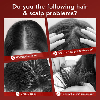 Electric Hair Regrowth Brush with Infrared Light Machine Acupoint Scalp Massage Anti-Hair Loss Exercise Hair Scrubber Combs