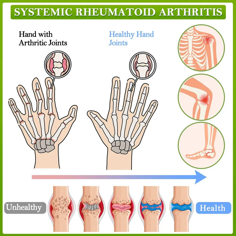 Bee Venom Joint Care Balm Care Lumbar Spine, Knee Muscle Pain, Muscle Soreness, Joint Care Balm Pure Natural Ingredients（30g）