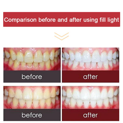 Dental Photography Equipment LED 2 In 1 Oral Filling Lamp Orthodontics Flash Light for Dentist Photo Fill Intraoral light