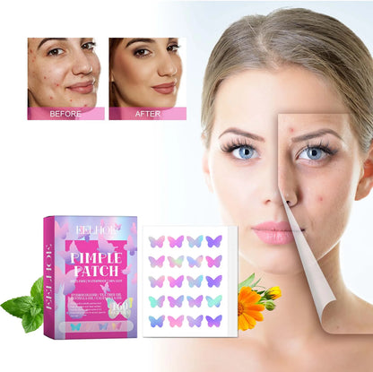 Pimple Patches for Face Cute Butterfly Shaped Acne Patches Hydrocolloid Cute Zit Stickers Parches Para Acne